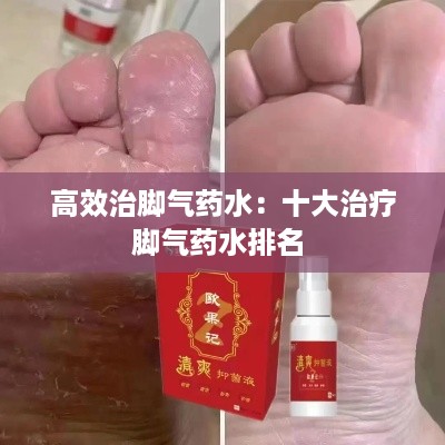 高效治脚气药水：十大治疗脚气药水排名 