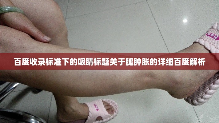 百度收录标准下的吸睛标题关于腿肿胀的详细百度解析