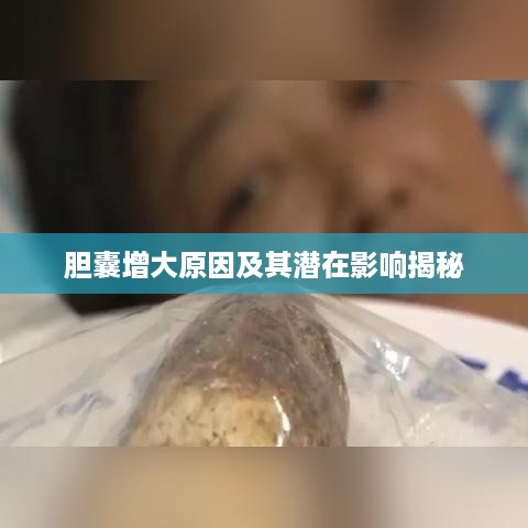 胆囊增大原因及其潜在影响揭秘