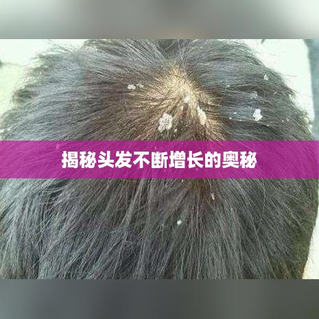 揭秘头发不断增长的奥秘