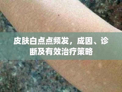 皮肤白点点频发，成因、诊断及有效治疗策略